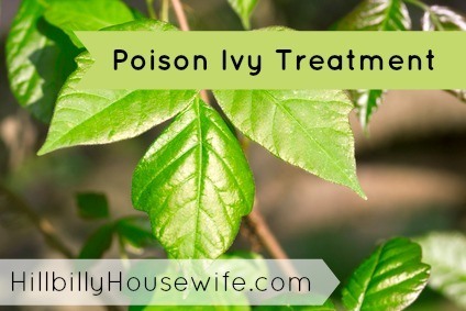 How do you treat poison ivy?